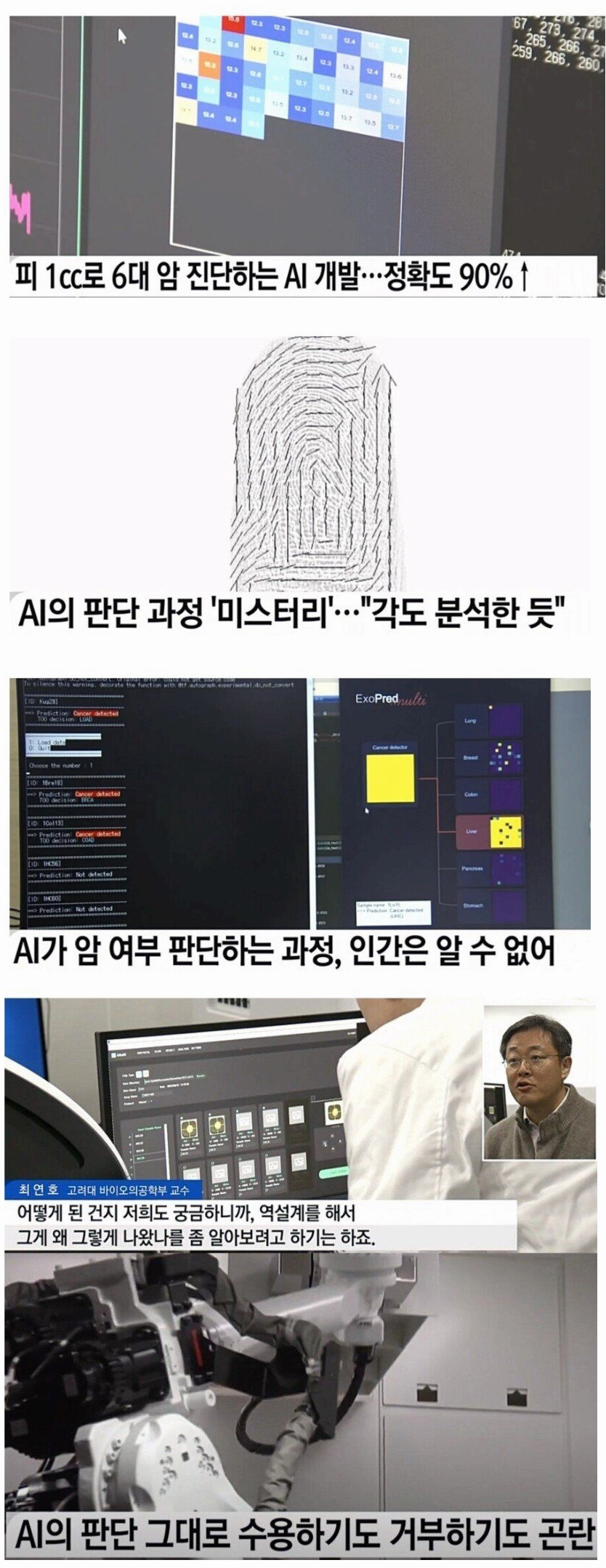 AI 암진단 90% 정확도