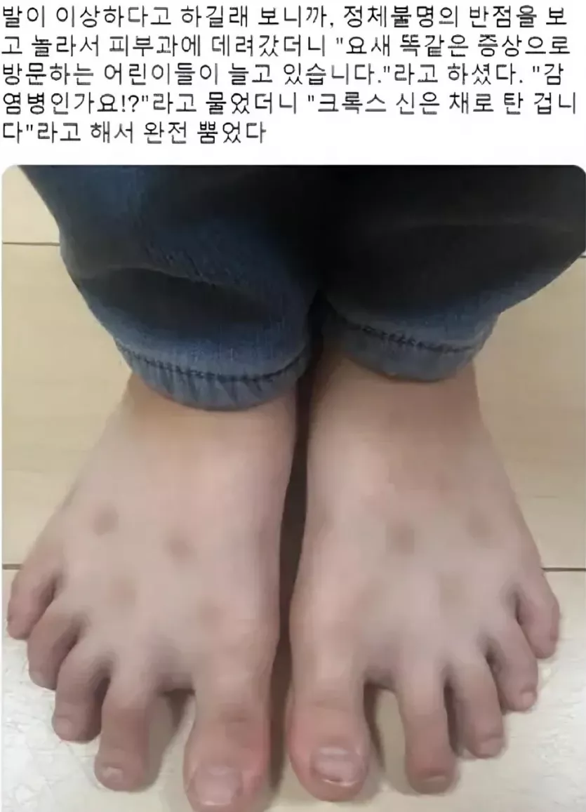 날씨 따뜻해지니 다시 유행하는 피부병